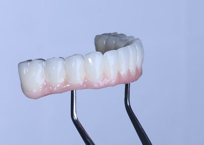 full arch dental implants